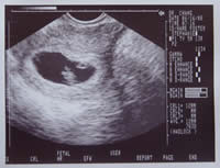 ultrasound