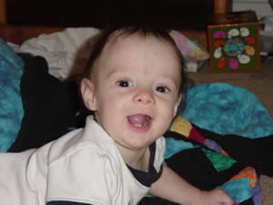 after helmet therapy