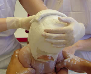 head casting - bandages going on back of head